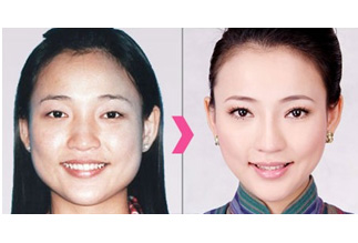 face slimming exercises before and after 0 2